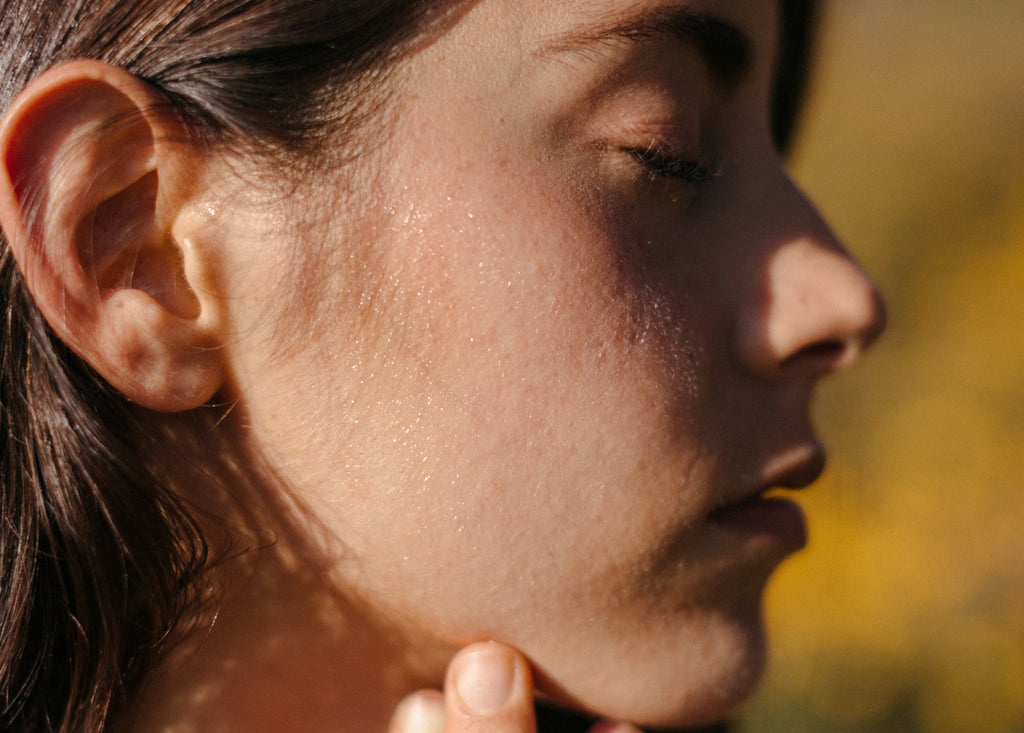 Acné, la manifestación más común del desbalance